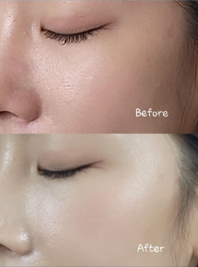 Marine Collagen Signature Sarga-X Ampoule